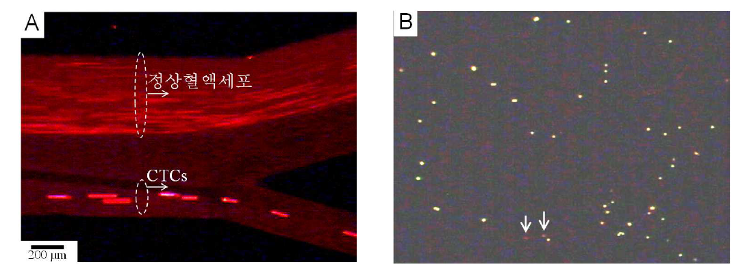 (A) 형광염색된 CTCs(녹색)와 정상유핵세포(적색)가 측면방향 자기 영동에 의해 출구 1번으 로 분리되는 모습. (B) 출구 1번으로 분리된 형광염색된 CTCs와 정상유핵세포(↓표시).