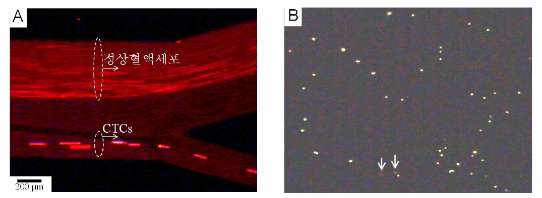(A) 형광염색된 CTCs(녹색)와 정상유핵세포(적색)가 측면방향 자기 영동에 의해 출구 1번으 로 분리되는 모습. (B) 출구 1번으로 분리된 형광염색된 CTCs와 정상유핵세포(↓표시).