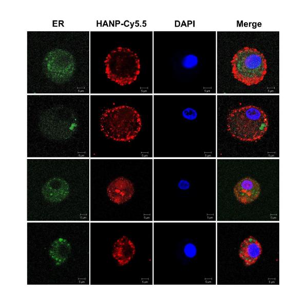 Subcellular localization of HA-NP is highlighted by yellow or orange fluorescence