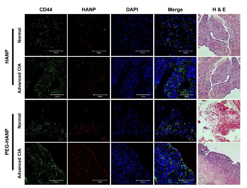 Cellular localization of HA-NP and PEG HA-NP within the inflamed synovial tissues.