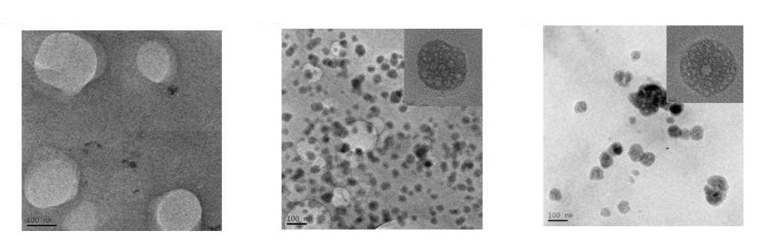 (좌)페길화된 히알루론산 나노입자, (중)인산칼슘화된 페길화 히알루론산 나노입자, (우)인산칼슘화된 MTX봉입 페길화 히알루론산 나노입자의 전자투과현미경(TEM)사진.