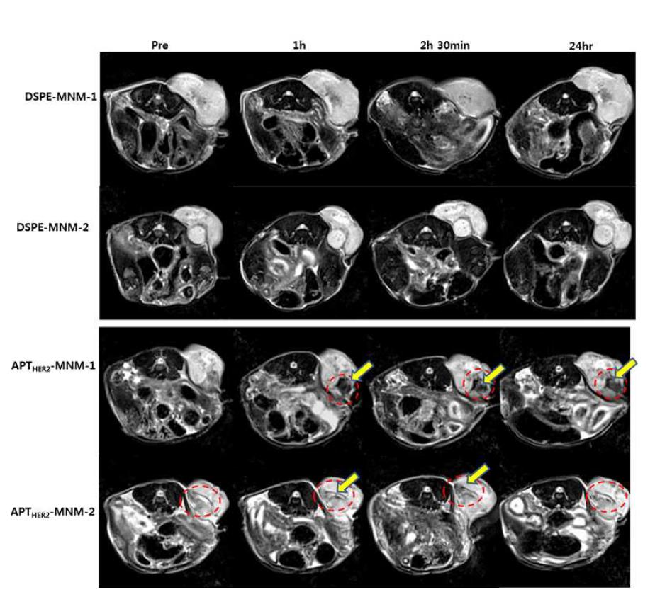NIH3T6.7동물 모델에서 DSPE-MNM과 APTHER2-MNM의 MR 영상