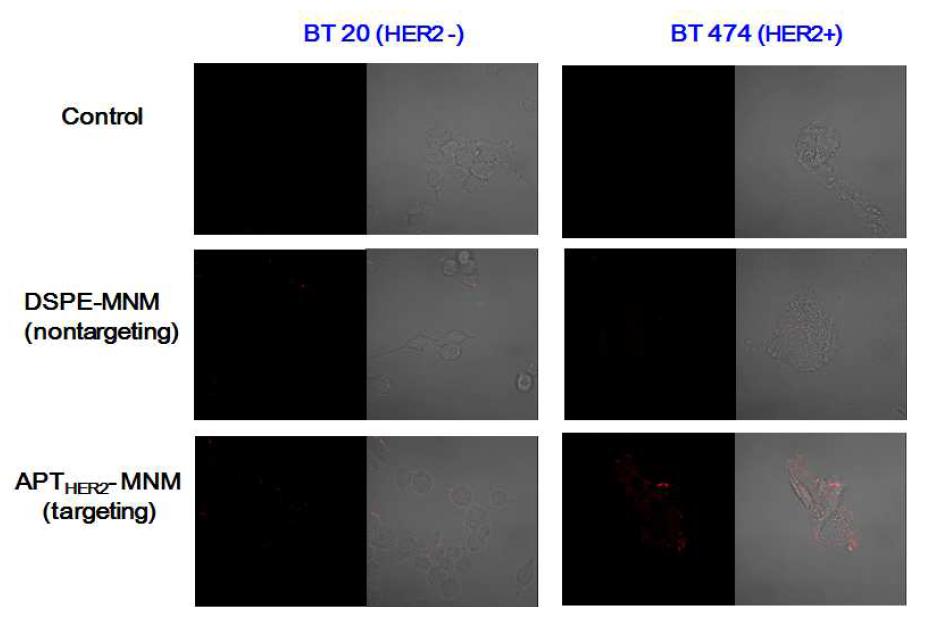 HER2 과발현 및 발현하지 않는 세포에서의 confocal 현미경 이미지.