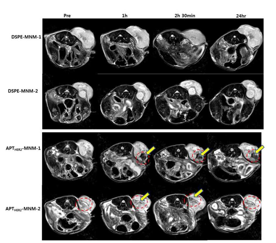 NIH3T6.7동물 모델에서 DSPE-MNM과 APTHER2-MNM의 MR 영상