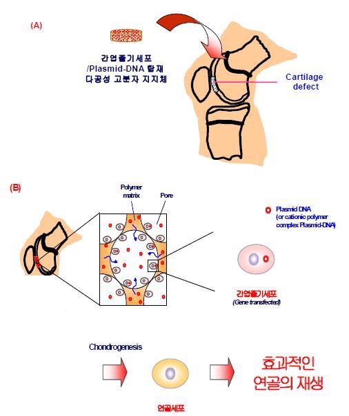 연골치료용 간엽줄기세포/plasmid DNA 탑재 다공성 고분자 지지체의 모식도 (A) 및 간엽줄기세포의 연골 재생 모식도 (B).