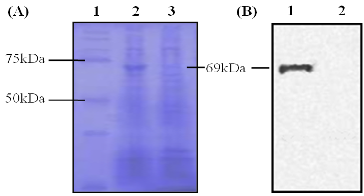 SDS-PAGE and Western blot analysis of expressed MGL_3996.