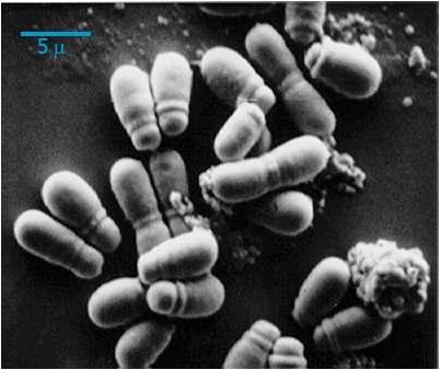 비듬의 주요 원인균인 말라쎄지아의 전자현미경 사진