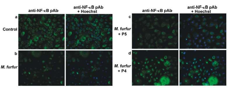 M. furfur가 infection된 human normal keratinocytes에서 antimicrobial peptideP5에 의한 NF-kB 발현 확인
