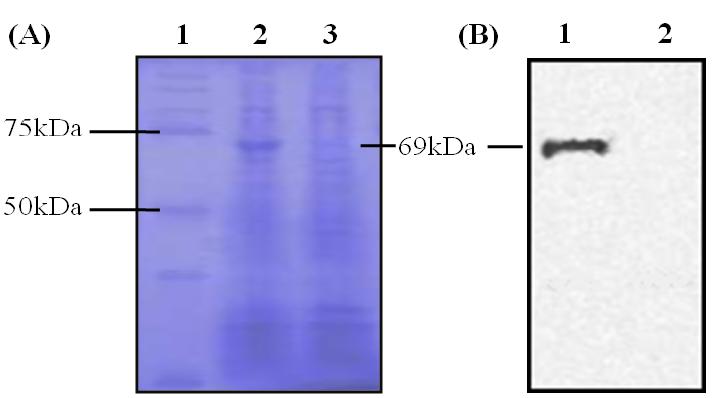 SDS-PAGE and Western blot analysis of expressed MGL_3996.