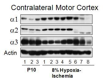 P7에 hypoxia/ischemia를 준 후, P10에 contralateral motor cortex를 분리하 여, GABA-A 수용체 subunit에 대한 Western blot을 실시함.