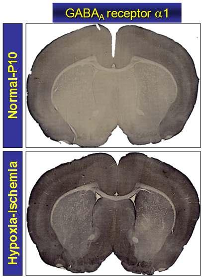 Hypoxia-Ishcemia를 준 rat brain을 coronal section한 후 α1 subunit 선택적 항체로 염색함.