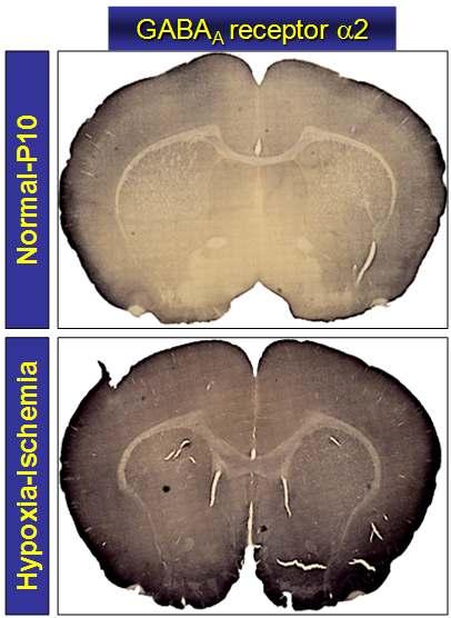 Hypoxia-Ishcemia를 준 rat brain을 coronal section한 후 α2 subunit 선택적 항체로 염색함.