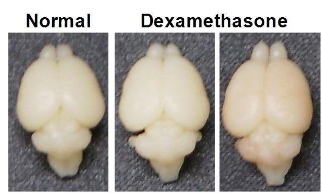 어미 rat에 dexamethasone을 투여한 후, P5 rat pup로부터 추출한 brain의 모양.
