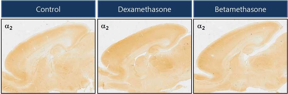 임신 14일 rat에 dexamethasone과 betamethasone을 SQ로 투여한 후, 출생 후 5일째 rat pup의 brain을 적출하여 GABA-A 수용체 α2 subunit에 대해 면역염색을 수행하였음.