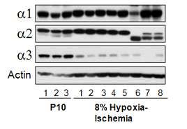 P7에 hypoxia/ischemia를 준 후, P10에 ipsilateral motor cortex를 분리하 여, GABA-A 수용체 subunit에 대한 Western blot을 실시함.