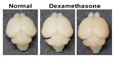 어미 rat에 dexamethasone 을 투여한 후, P5 rat pup로부터 추 출한 brain의 모양.