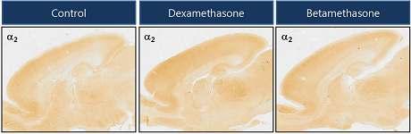 임신 14일 rat에 dexamethasone과 betamethasone을 SQ로 투여한 후, 출생 후 5일째 rat pup의 brain을 적출하여 GABA-A 수용체 a2 subunit에 대해 면역염색을 수행하였음.