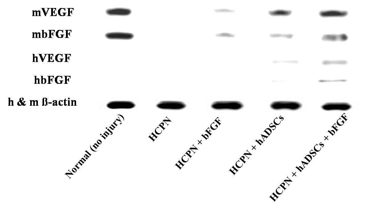 Western blot analysis 를 통해 확인한 human 및 mouse VEGF receptor, bFGF receptor 발현결과.