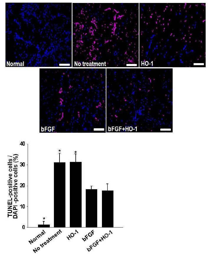 HO-1 및 bFGF, HO-1과 bFGF 복합 치료 12시간 후 마우스 하지허혈 부위의세포사멸도 조사 (TUNEL assay, 붉은색: apoptotic cell, 파란색: nucelus)