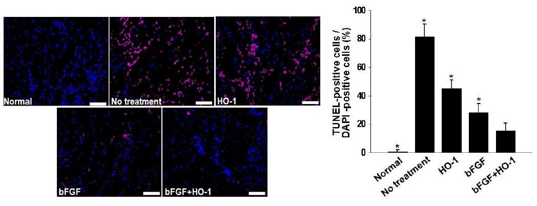 HO-1 및 bFGF, HO-1과 bFGF 복합 치료 10일 후 마우스 하지허혈 부위의 세포사멸도조사 (TUNEL assay, 붉은색: apoptotic cell, 파란색: nucelus)