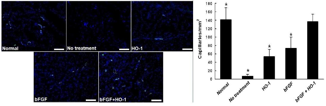 HO-1 및 bFGF, HO-1과 bFGF 복합 치료 28일 후 마우스 하지허혈 부위의 모세혈관분포도 조사(vWF staining, 파란색: nucelus, 초록색: 모세혈관)