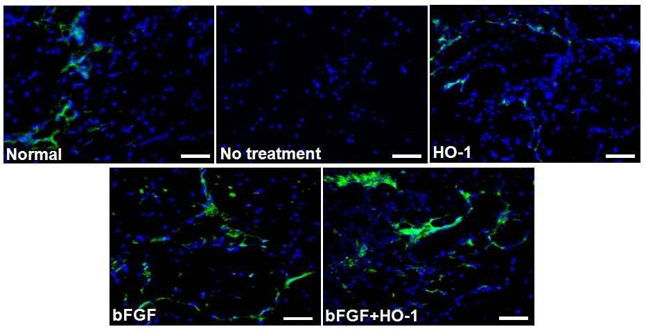 HO-1 및 bFGF, HO-1과 bFGF 복합 치료 28일 후 마우스 하지허혈 부위의 VEGF단백질 생성 정도 조사(VEGF immunostaining result)