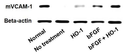 HO-1 및 bFGF, HO-1과 bFGF 복합 치료 28일 후 마우스 하지허혈 부위의 maturedvessle 존재 정도 조사(Western blot result)