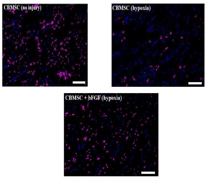 마우스 하지허혈 부위에 이식된 hCBMSCs의 생존 및 분포도 조사 (파란색:세포핵(DAPI), 붉은색: 이식된 세포(HNA, human nucleus))