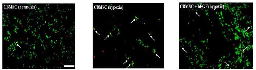 마우스 하지허혈 부위에 이식된 hCBMSCs의 세포사멸도 조사(TUNEL assay, 초록색: 이식된 세포(eGFP), 붉은색: apoptotic cell, 노란색: 이식된 세포 중 apoptotic cell)