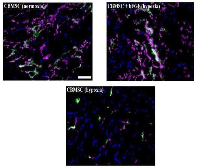 마우스 하지허혈 부위에서 hCBMSCs에 의해 발현되는 VEGF 조사 (붉은색: humannucleus, 파란색: 세포핵(DAPI), 초록색: human specific antibody for VEGF)