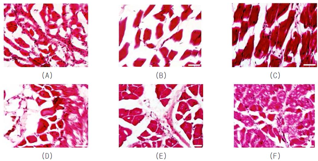 H&E염색을 통한 하지 허혈 부위에서의 근육 퇴화 및 섬유화 확인