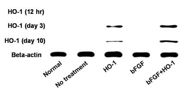 마우스 하지허혈 부위에 이식된 HO-1 유전자의 시간에 따른 발현과 HO-1 단백질의생성 (Western blot analysis)