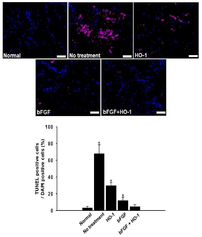 HO-1 및 bFGF, HO-1과 bFGF 복합 치료 3일 후 마우스 하지허혈 부위의 세포사멸도조사 (TUNEL assay, 붉은색: apoptotic cell, 파란색: nucelus)