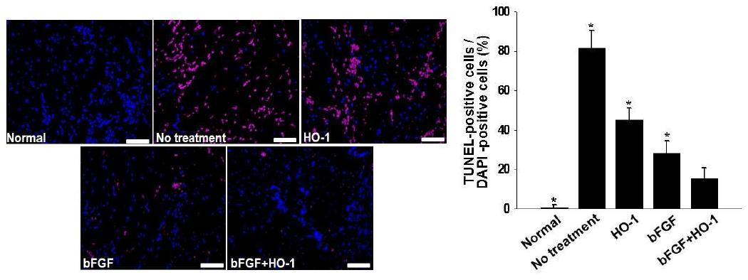 HO-1 및 bFGF, HO-1과 bFGF 복합 치료 10일 후 마우스 하지허혈 부위의 세포사멸도조사 (TUNEL assay, 붉은색: apoptotic cell, 파란색: nucelus)