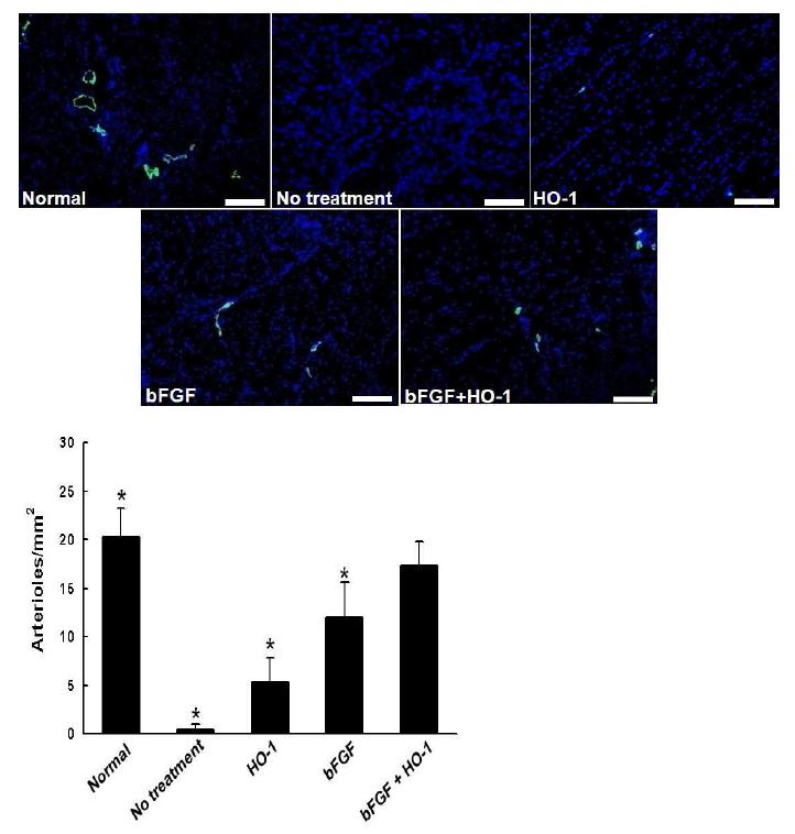 HO-1 및 bFGF, HO-1과 bFGF 복합 치료 28일 후 마우스 하지허혈 부위의 세동맥 분포도 조사(smooth muscle alpha actin staining, 파란색: nucelus, 초록색: 세동맥)