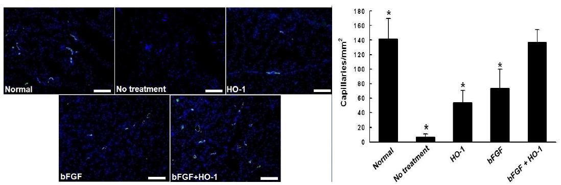 HO-1 및 bFGF, HO-1과 bFGF 복합 치료 28일 후 마우스 하지허혈 부위의 모세혈관 분포도 조사(vWF staining, 파란색: nucelus, 초록색: 모세혈관)