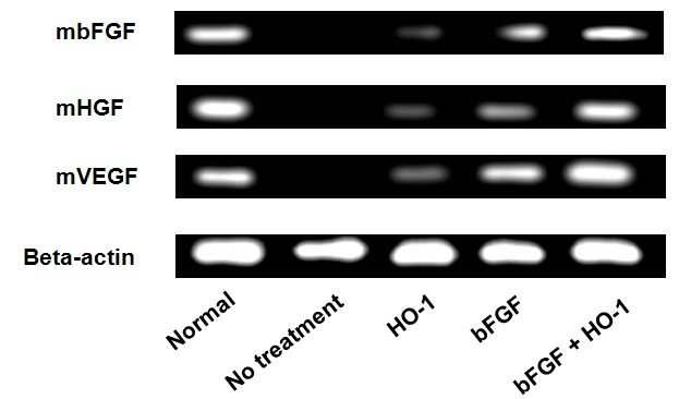 HO-1 및 bFGF, HO-1과 bFGF 복합 치료 28일 후 마우스 하지허혈 부위의 혈관 생성 인자 유전자의 발현 조사(RT-PCR)