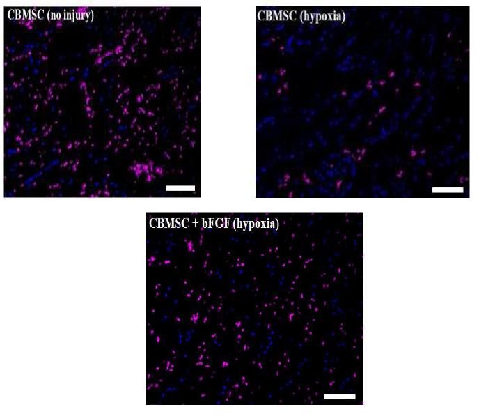 마우스 하지허혈 부위에 이식된 hCBMSCs의 생존 및 분포도 조사 (파란색: 세포핵(DAPI), 붉은색: 이식된 세포(HNA, human nucleus))