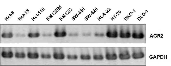 RT-PCR analysis를 이용한 여러 대장암 유래 세포주들에 있어서 AGR2 유전자의 발현 양상의 비교 분석