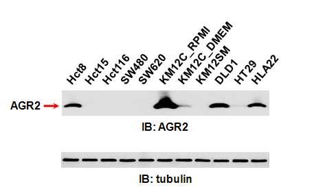 Western blot analysis를 이용한 여러 대장암 유래 세포주들에서 있어서 AGR2 단백질의 발현 양상의 비교 분석