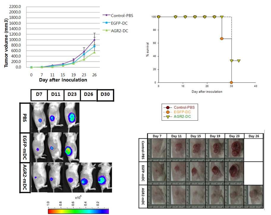 대장암 종양 모델에서 재조합 AGR2 아데노바이러스가 도입된 수지상세포를 이용한 후, 종양 억제효과의 확인.