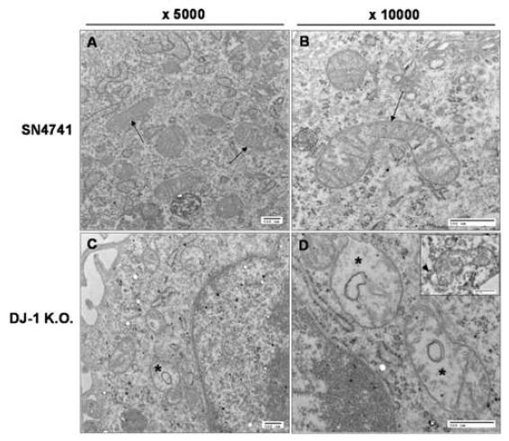 유전성 도파민 DJ-1 K.O. 세포에서 미토콘드리아 크리스타 구조 이상 (*) 관찰