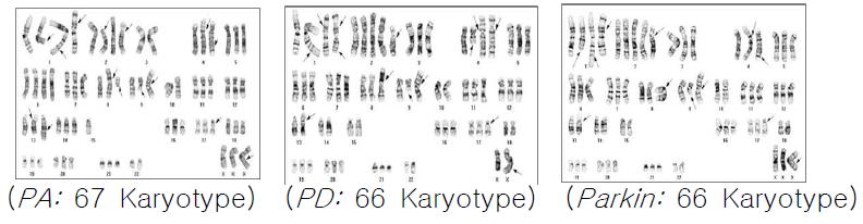 불멸화된 파킨슨환자 및 뇌하수체 [ 16. 선종환자의 지방유래 간엽줄기세포의 염색체 Karyotyping 분석