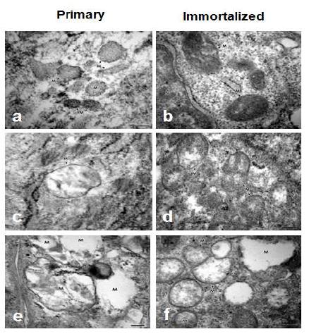 파킨슨환자 및 뇌하수체 선종환자의 지방유래 간엽줄기세포의 Primary와 Immortalized 세포 의 미토콘드리아 형태의 Electron micrograph
