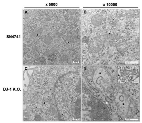 유전성 도파민 DJ-1 K.O. 세포에서 미토콘드리아 크리스타 구조 이상 (*) 관찰