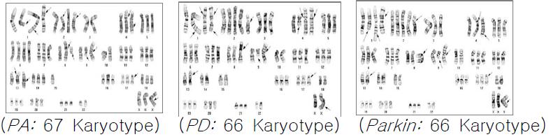 불멸화된 파킨슨환자 및 뇌하수체 선종환자의 지방유래 간엽줄기세포의 염색체 Karyotyping 분석