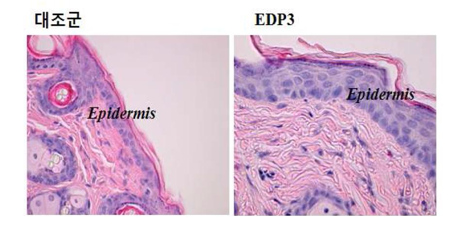 EDP3 처리에 의한 mouse 피부 조직의 변화.