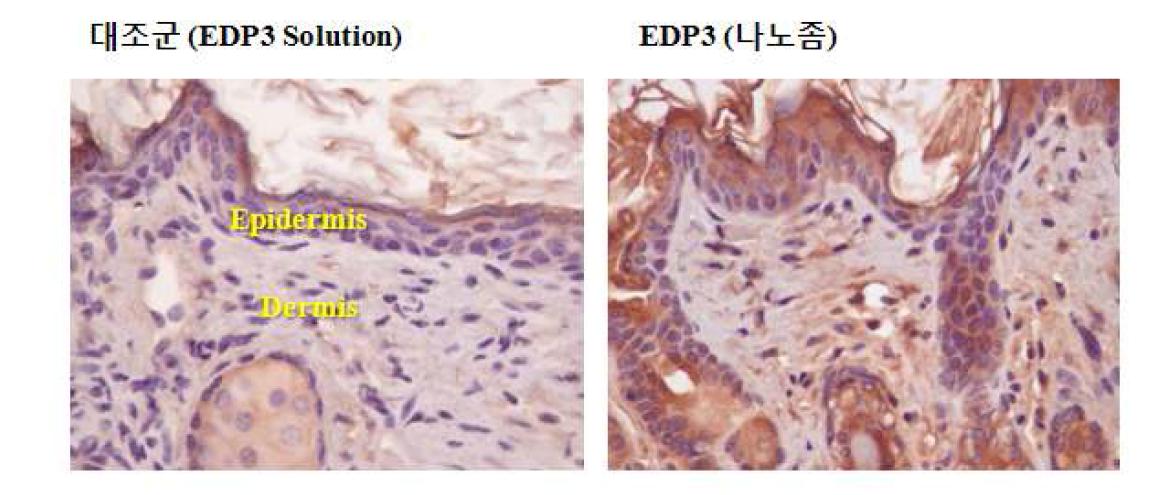 EDP3 의 피부 투과도 관찰