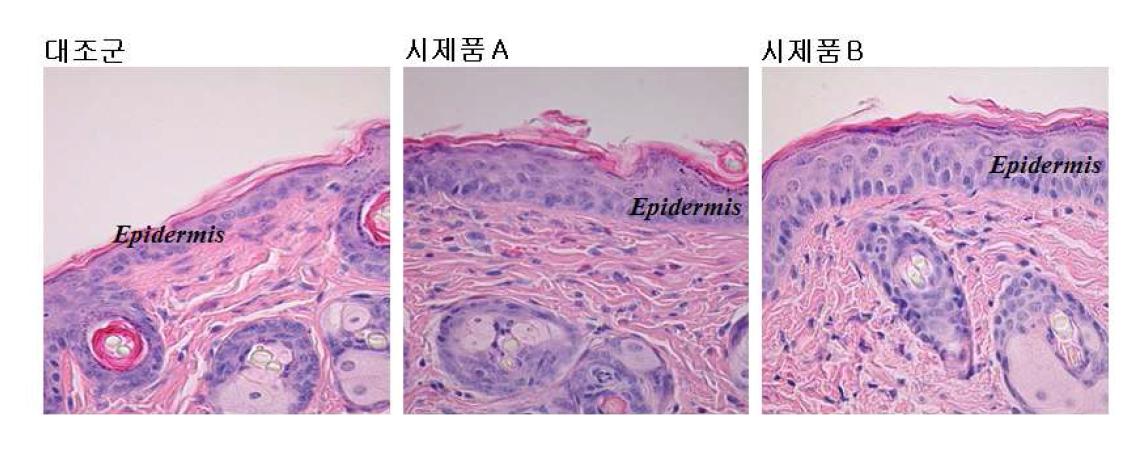 EDP3 시제품 처리에 의한 mouse 피부 조직의 변화