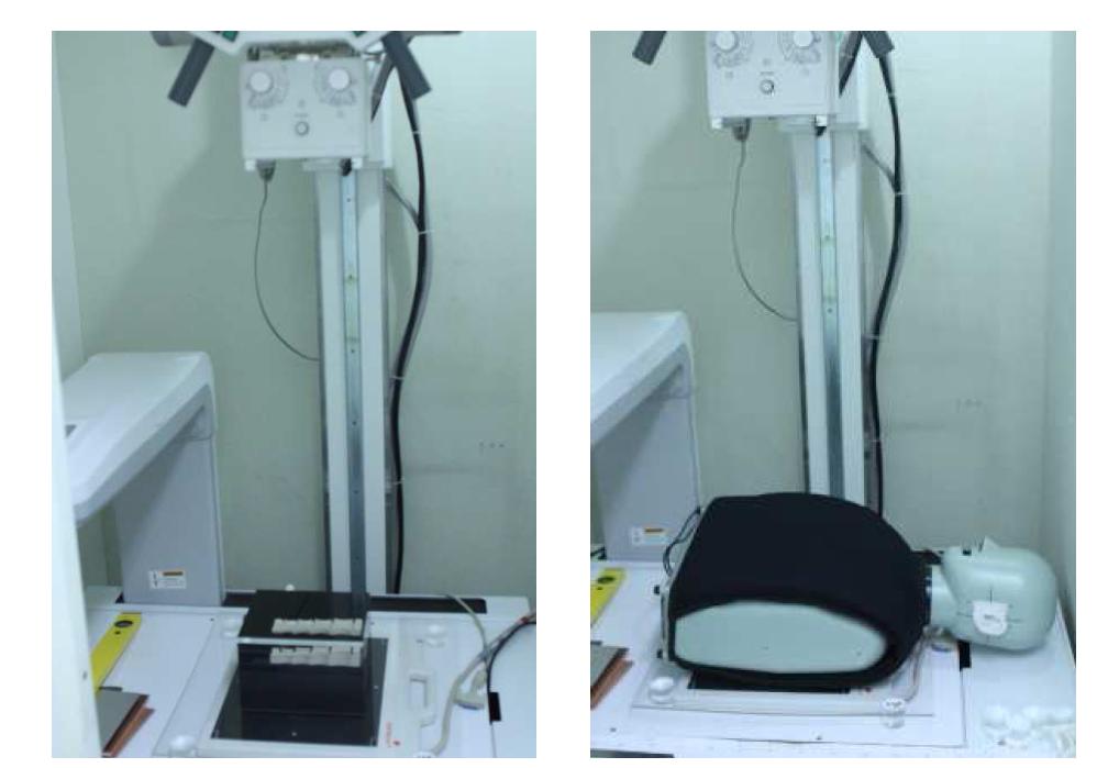 본 연구에 사용된 conebam 방식의 골밀도 측정 실험 환경